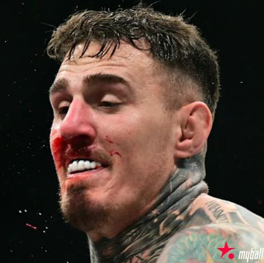 大发体育-UFC冠军汤姆将继续进行双眼手术，大发助力你的致富之路！【EV扑克官网】