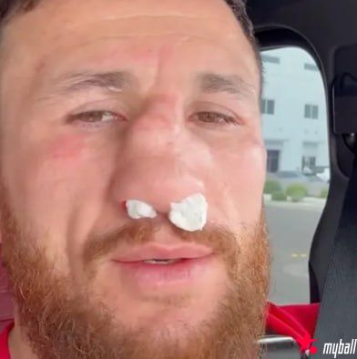 梅拉布·德瓦利什维利鼻骨两处骨折仍要打！放话硬刚亨利·塞胡多，大发体育助力你的致富之路！【EV扑克官网】